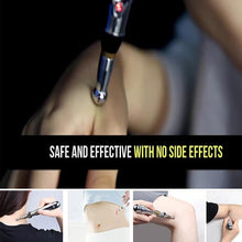 Load image into Gallery viewer, Laser Acupuncture Pen